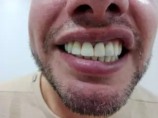  — paso 2 de 3 · White Smile Odontología, Chapinero, Bogotá