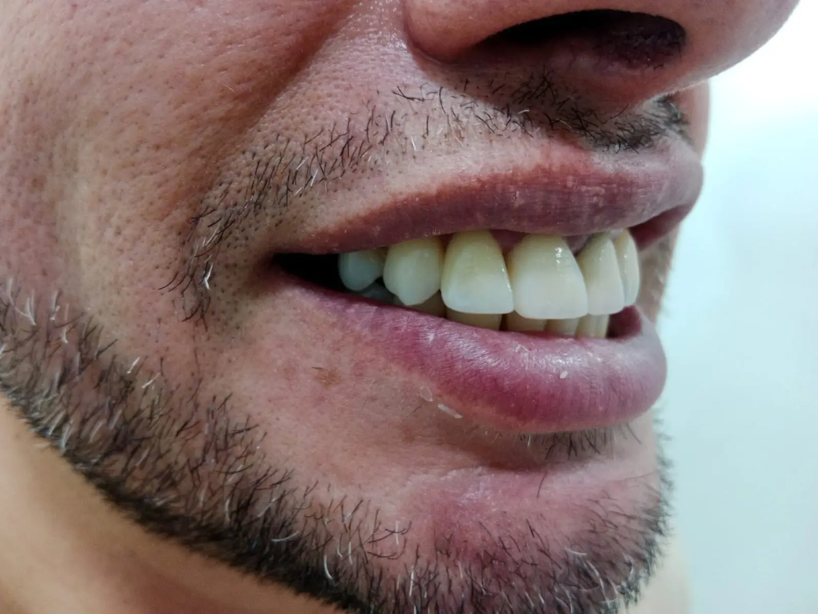  — paso 1 de 3 · White Smile Odontología, Chapinero, Bogotá