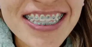  — paso 2 de 3 · White Smile Odontología, Chapinero, Bogotá