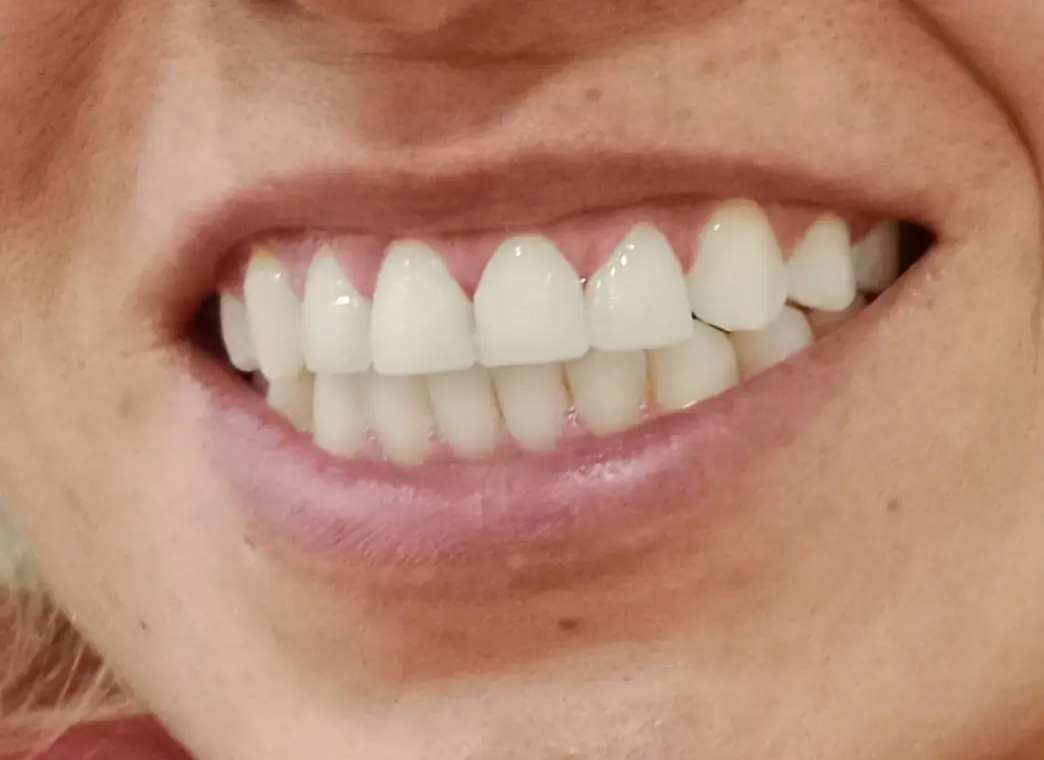  — paso 1 de 3 · White Smile Odontología, Chapinero, Bogotá