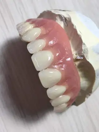 Prótesis total superior — paso 2 de 2 · White Smile Odontología, Chapinero, Bogotá