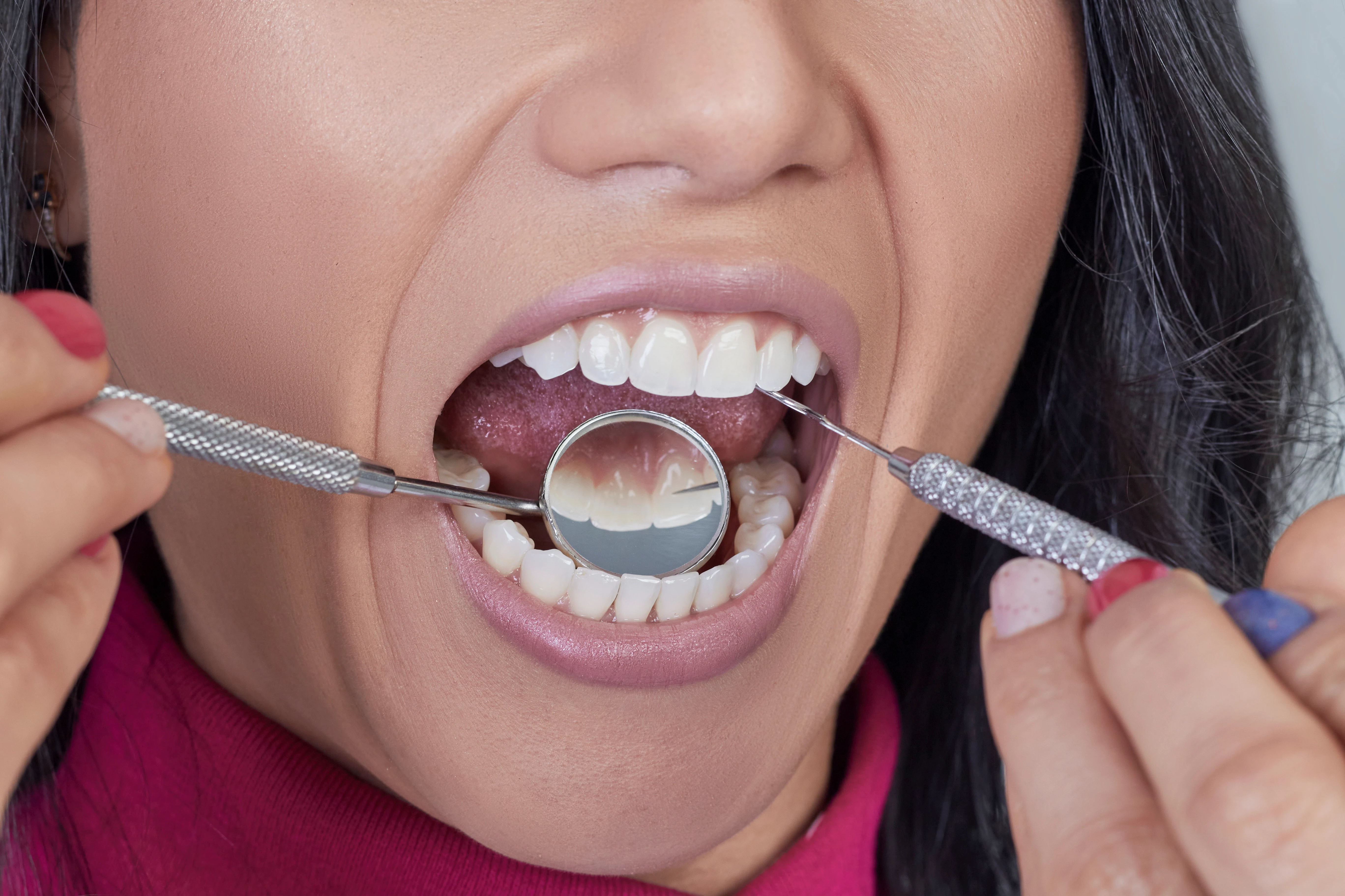 Odontóloga general de White Smile Odontología revisando a una paciente en Bogotá